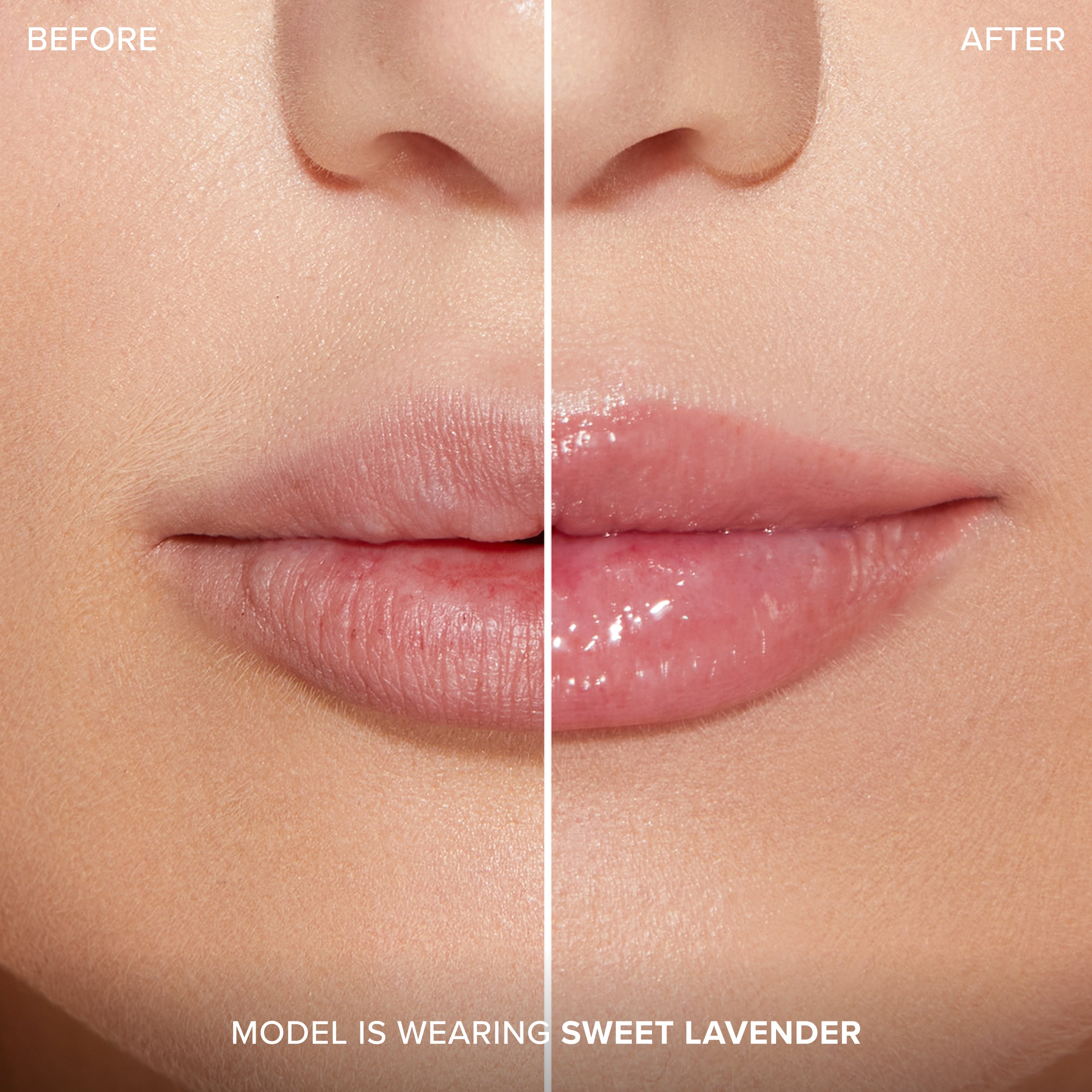 Lip Injection Extreme Plumping Clicks